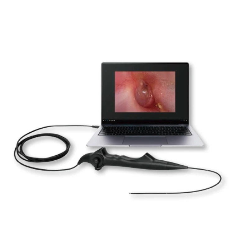 Fleksibl rinolaringoskop — ince uçlu esnek endoskop, USB ile laptopa bağlı, ekranda endoskopik görüntü